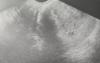 a0b25be453146.jpg
